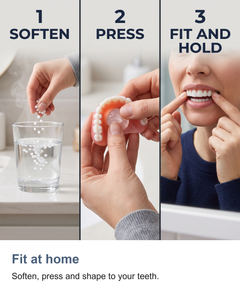Snap on false teeth set: Fit at home