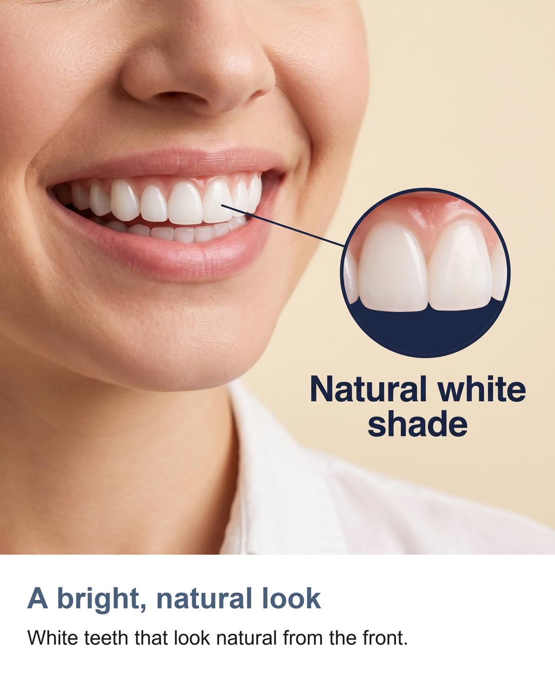 Snap on false teeth set: A bright, natural look