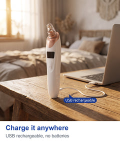 Charge it anywhere: USB rechargeable pore vacuum device, no batteries needed